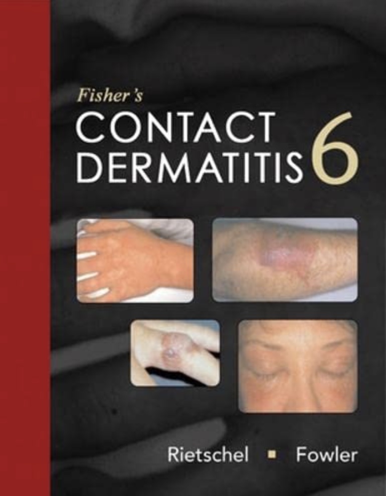 Contact Dermatitis 6